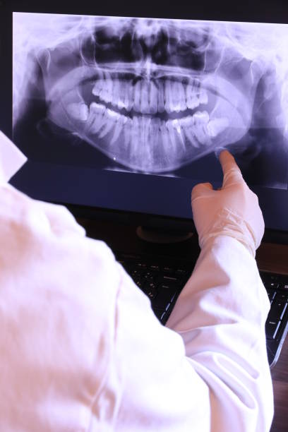 Best Emergency Dentist for Lost Fillings or Crowns in Lynn Haven, FL