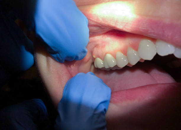 Best Pediatric Emergency Dentist in Lynn Haven, FL